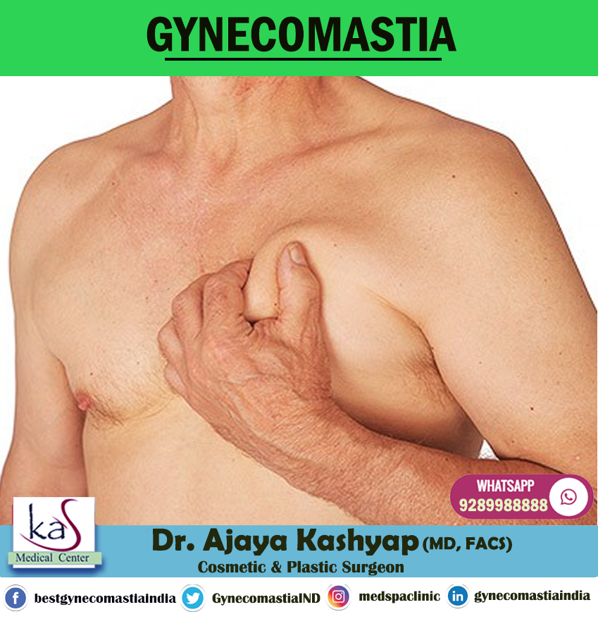 Treatment of Gynecomastia in India